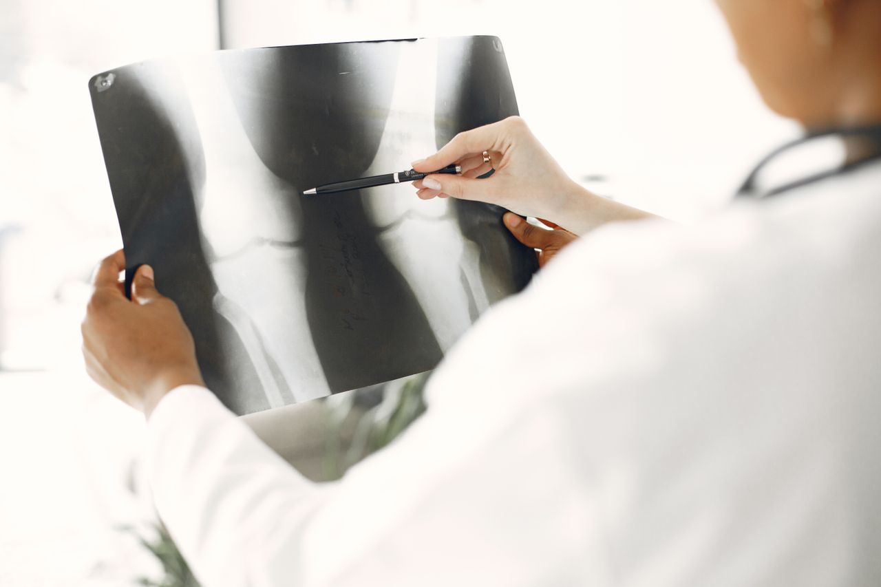 The Art of Drawing Readers In: Your attractive post title goes here A medical professional closely examines a leg X-ray, pointing out details with a pen.