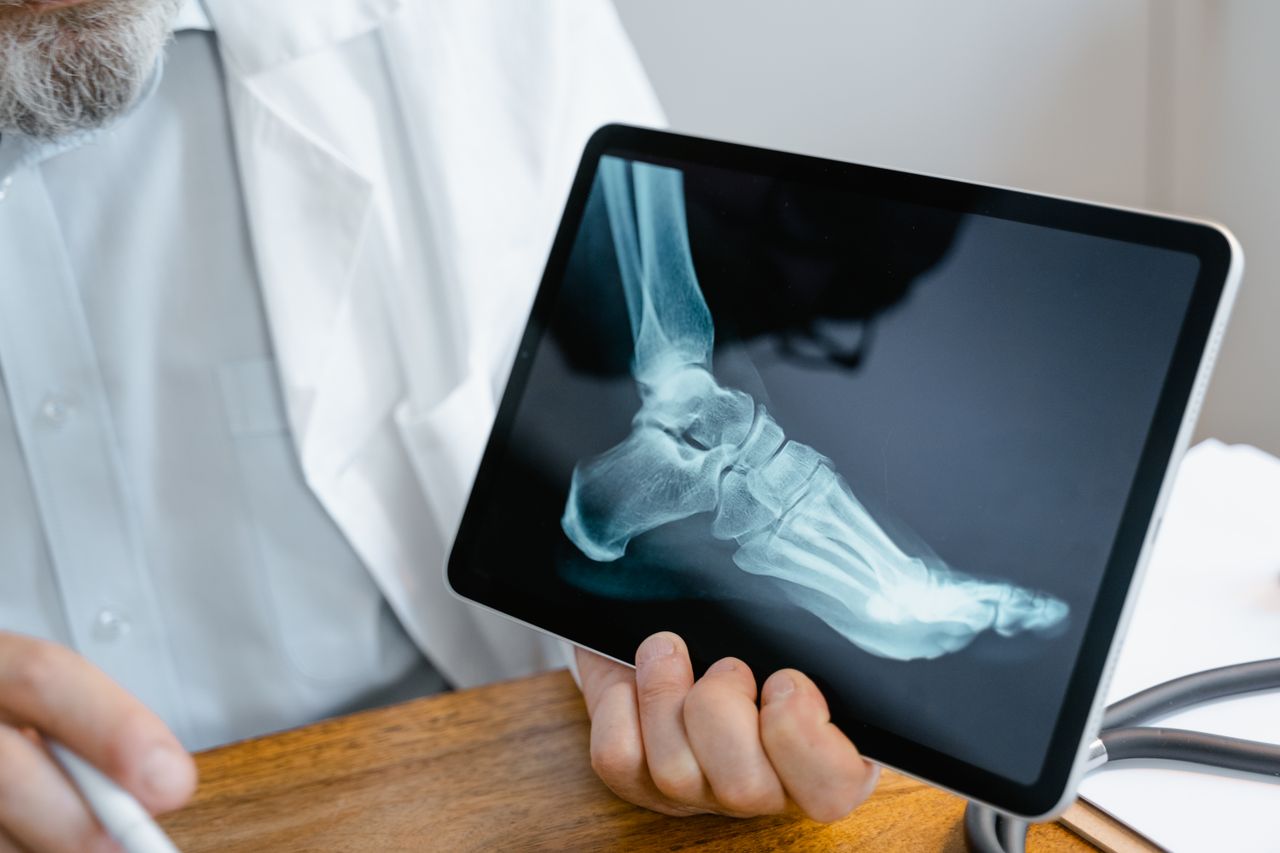 Crafting Captivating Headlines: Your awesome post title goes here A doctor examines an x-ray image of a foot displayed on a tablet.